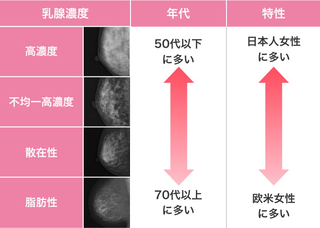特徴6 日本人に適している理由 | 無痛MRI乳がん検診（痛くない乳がん検診）